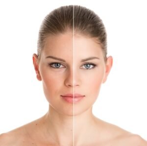 Read more about the article Skin Rejuvenation in Kolkata—Let Your Skin Catch Up with You