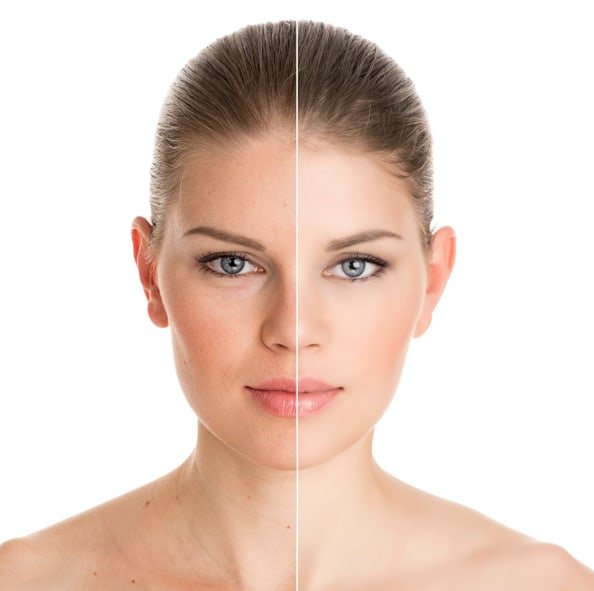 You are currently viewing Skin Rejuvenation in Kolkata—Let Your Skin Catch Up with You